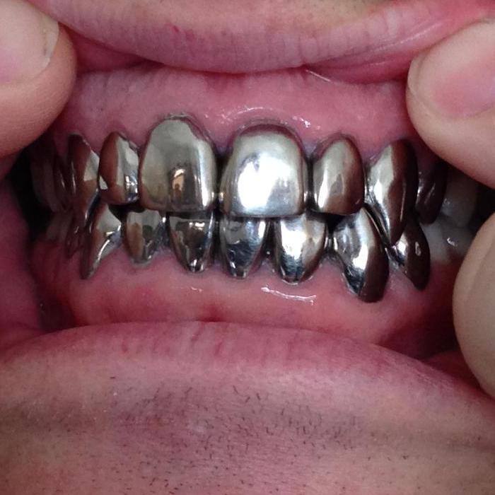 Metal teeth